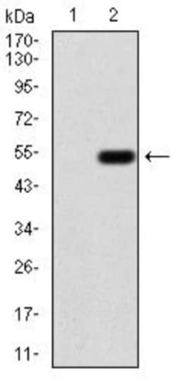Emerin Antibody (8F5A8) - BSA Free, Novus Biologicals 0.1mg; Unlabeled:Antibodies,